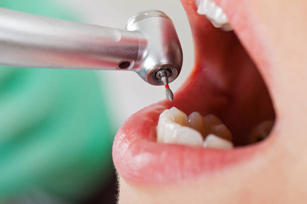 Best Emergency Dental Care for Broken or Chipped Teeth in Niles, MI